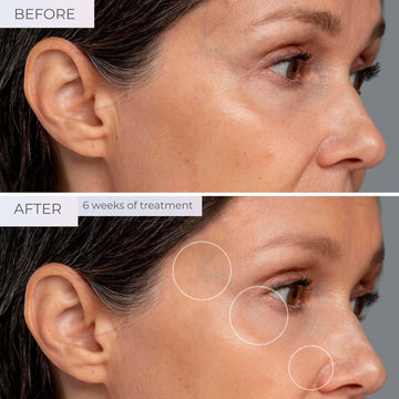 glow vs klow peptide The Glow Peptide Blend Sounds Cute, But Means Business for Your Skin