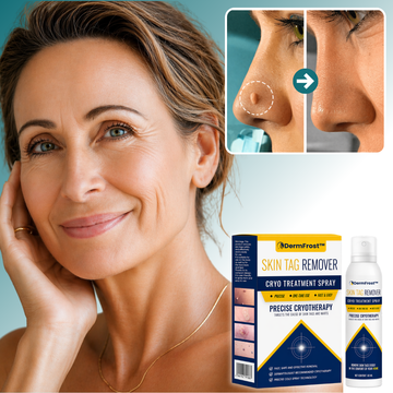DermFrost™ | Cryo Treatment Spray