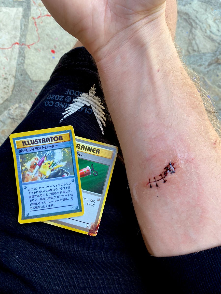found out my $2M Pikachu Illustrator card was fake, got angry & punched a window (it was supposed to be a joke), ended up nearly bleeding out and got 9 stitches. I've