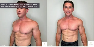 cjc ipamorelin before and after Ipamorelin Peptide Therapy in Florida: The Gentle Path to Recovery &