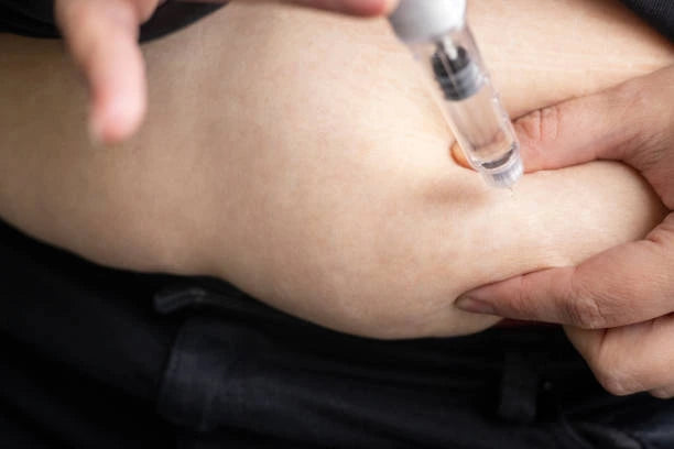 What Are the Recommended GLP-1 Injection Sites?