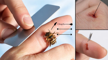 How to Remove a Bee Stinger Safely and Treat a Sting Effectively