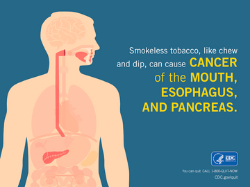 Quitting Smokeless Tobacco: A Success Story