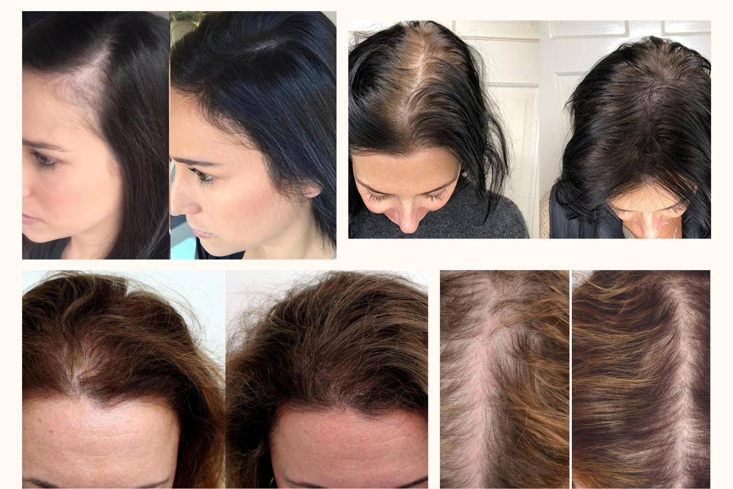 ghk cu peptide before and after hair female injection Understanding the Difference Between Glow and GHKCU